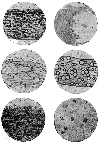Схема расположения элементов грибов в чешуйке и в волосе. 1 — трихофитон эндотрикс; 2 — трихофитон эктотрикс мелкоспоровый; 3 —трнхофитон эктотрикс крупноспоровый; 4 — микроспорон; 5 — ахорион Шонлейна; 6—элементы гриба в чешуйке