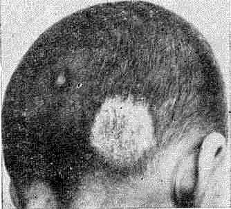Микроспория волосистой части головы («кошачья»)