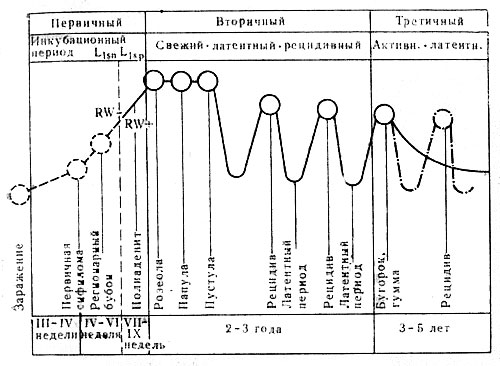 Схема течения сифилиса